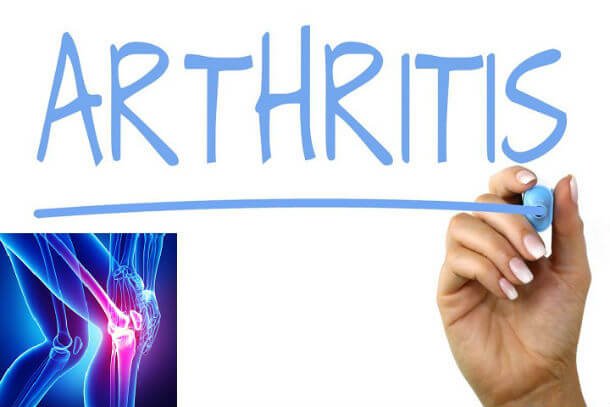 जानिए आर्थराइटिस के प्रकार, लक्षण तथा आधुनिक उपचार Gathiya arthritis ke prakar lakshan ilaj