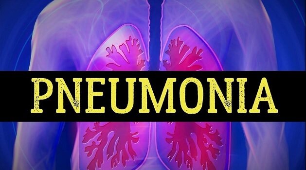 निमोनिया बुखार के लक्षण, कारण तथा बचाव की जानकारी pneumonia lakshan karan ilaj bachne upay